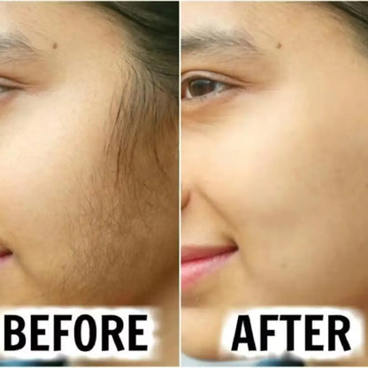 MEEOW 10-Min Painless DIY Hair Removal Mask